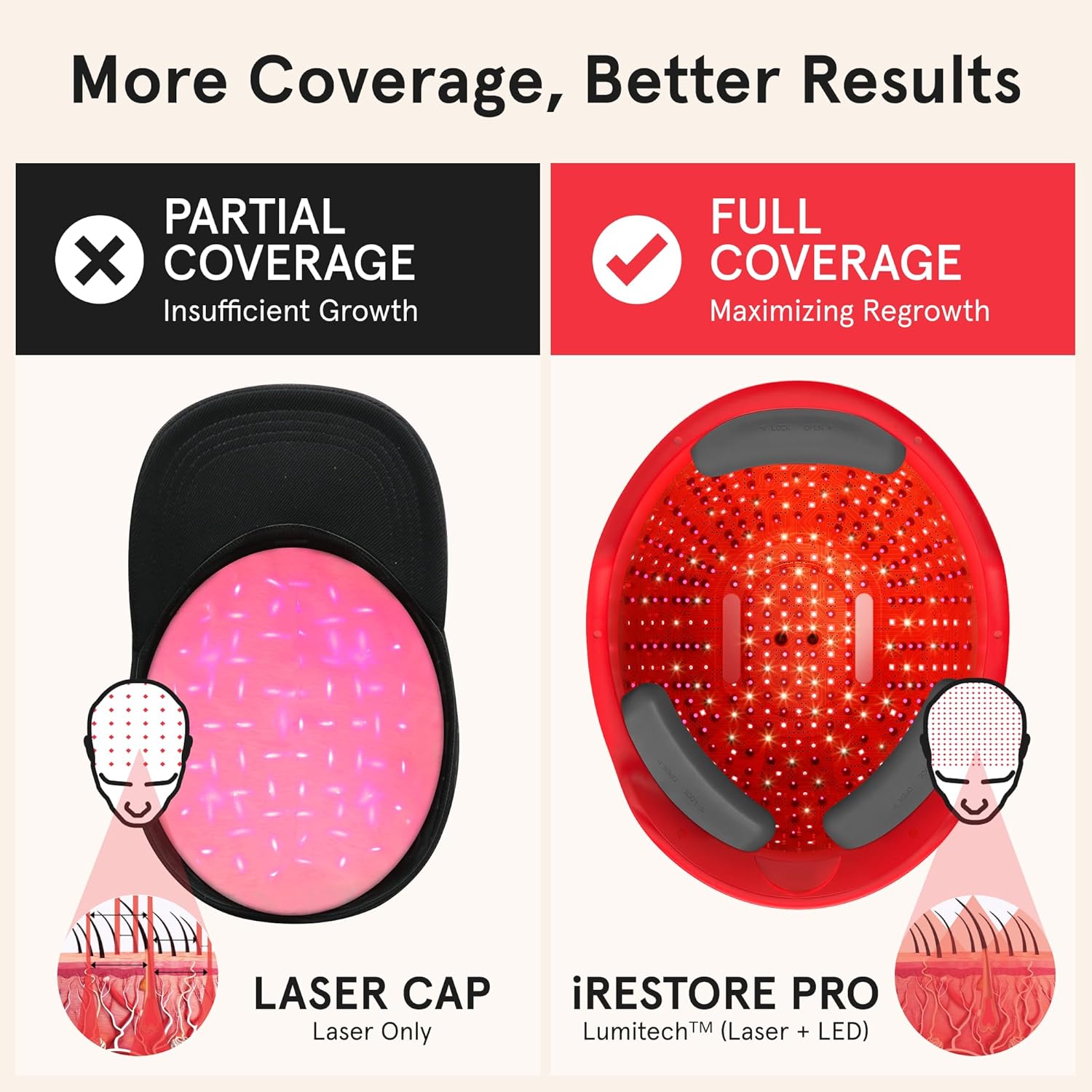 81XGIMahJ7L._SL1500_